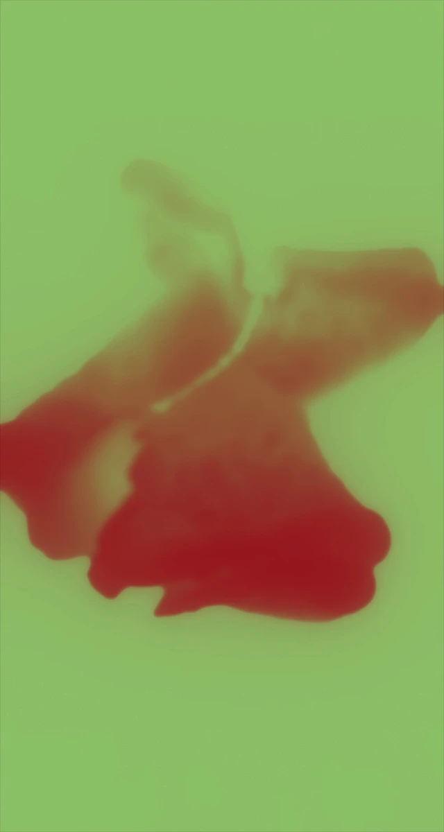 Ultrasound