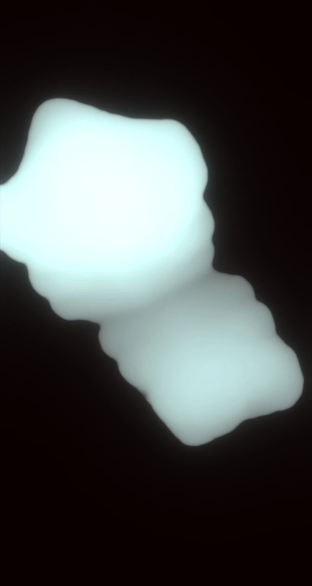 Ultrasound