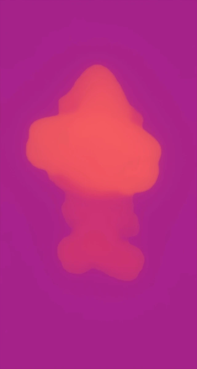 Ultrasound