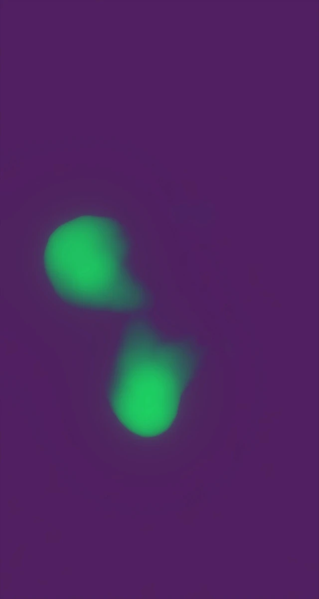 Ultrasound
